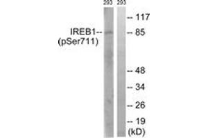 Western blot analysis of extracts from 293 cells treated with insulin 0. (Aconitase 1 antibody  (pSer711))