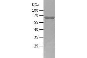 Western Blotting (WB) image for Growth Associated Protein 43 (GAP43) (AA 1-238) protein (His-IF2DI Tag) (ABIN7283825) (GAP43 Protein (AA 1-238) (His-IF2DI Tag))