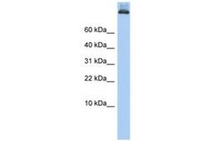 Image no. 1 for anti-Coatomer Protein Complex, Subunit alpha (COPA) (AA 396-445) antibody (ABIN6743601) (COPA antibody  (AA 396-445))