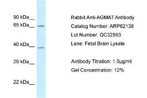 Western Blotting (WB) image for anti-Agmatine Ureohydrolase (Agmatinase) (AGMAT) (N-Term) antibody (ABIN2789033) (AGMAT antibody  (N-Term))