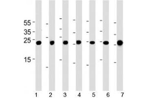 Cebpd antibody western blot analysis in 1) A549, 2) HeLa, 3) NCI-H460, 4) U-937, 5) mouse NIH3T3 cell line, rat 6) lung and 7) testis tissue lysate. (CEBPD antibody  (AA 161-189))