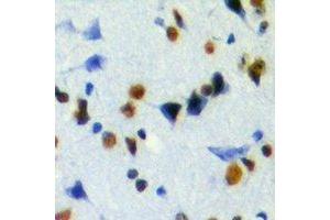 Immunohistochemical analysis of JMJD6 staining in mouse brain formalin fixed paraffin embedded tissue section. (JMJD6 antibody)