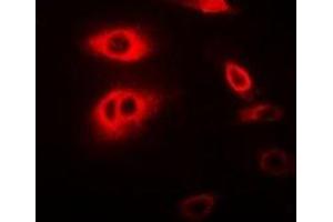 Immunofluorescent analysis of RIPK2 staining in MCF7 cells. (RIPK2 antibody)