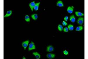 Immunofluorescence staining of Hela cells with ABIN7159009 at 1:133, counter-stained with DAPI. (MARVELD3 antibody  (AA 1-189))