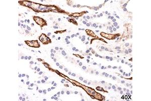 IHC testing of FFPE human kidney transplant tissue (40X) stained with Complement 4d / C4d antibody (C4D204). (Complement C4d antibody)