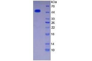SDS-PAGE of Protein Standard from the Kit (Highly purified E. (SERPINC1 CLIA Kit)