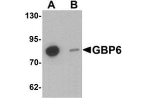Western blot analysis of GBP6 in Hela cell lysate with GBP6 Antibody  at 0. (GBP6 antibody  (C-Term))