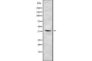 Western blot analysis SETD7 using Jurkat whole cell lysates (SETD7 antibody  (Internal Region))