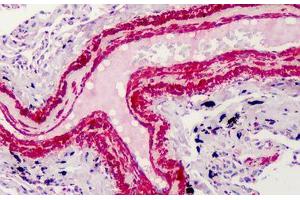 Human Smooth Muscle: Formalin-Fixed, Paraffin-Embedded (FFPE) (Smooth Muscle Actin antibody  (N-Term))