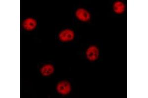 ABIN6274375 staining HT29 cells by IF/ICC. (NAB2 antibody  (C-Term))