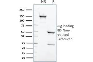 SDS-PAGE Analysis Purified PTPN6 Mouse Monoclonal Antibody (CPTC-PTPN6-2). (SHP1 antibody)