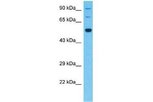 Host:  Rabbit  Target Name:  SLC5A8  Sample Type:  Fetal Kidney lysates  Antibody Dilution:  1.