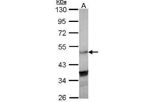 WB Image Sample (30 ug of whole cell lysate) A: Molt-4 , 10% SDS PAGE antibody diluted at 1:1000 (NR1H3 antibody  (C-Term))