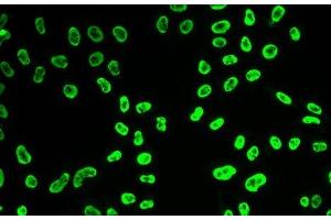 Immunofluorescence analysis of HeLa cells using SNRPA Polyclonal Antibody (SNRPA1 antibody)