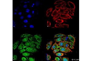 Immunocytochemistry/Immunofluorescence analysis using Rabbit Anti-GLUT2 Polyclonal Antibody .