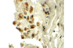 Immunohistochemical staining of human lung cells with TYW1 polyclonal antibody  at 5 ug/mL.