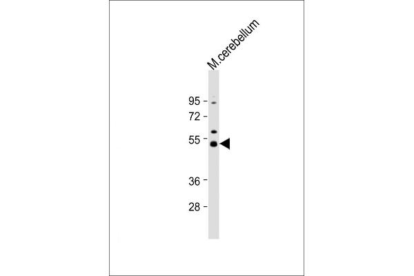 Dnmt2 antibody  (AA 346-375)