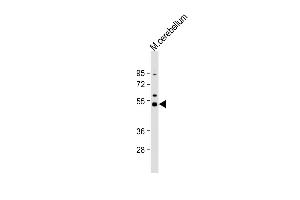 Anti-Dnmt2 Antibody  at 1:1000 dilution + mouse cerebellum lysate Lysates/proteins at 20 μg per lane. (Dnmt2 antibody  (AA 346-375))