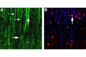 Expression of α1D-Adrenoceptor in rat neocortex - Immunohistochemical staining of α1D-adrenoceptor in rat neocortex using Anti-α1D-Adrenergic Receptor (extracellular) Antibody (ABIN7042896, ABIN7043916 and ABIN7043917). (ADRA1D antibody  (Cys240Ser-Mutant, Extracellular))
