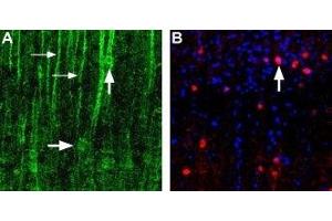 Expression of α1D-Adrenoceptor in rat neocortex - Immunohistochemical staining of α1D-adrenoceptor in rat neocortex using Anti-α1D-Adrenergic Receptor (extracellular) Antibody (ABIN7042896, ABIN7043916 and ABIN7043917).