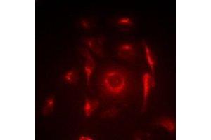 Immunofluorescent analysis of ACAS2 staining in SW620 cells. (ACSS2 antibody)