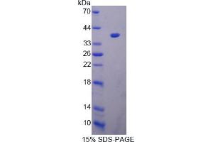 Image no. 1 for Peptidyl Arginine Deiminase, Type III (PADI3) (AA 1-300) protein (His tag) (ABIN4990460) (PADI3 Protein (AA 1-300) (His tag))