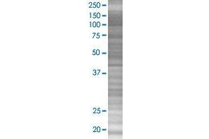 BID transfected lysate. (BID 293T Cell Transient Overexpression Lysate(Denatured))