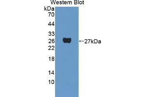 Figure. (PAG1 antibody  (AA 138-357))