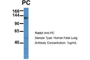 Host: Rabbit  Target Name: PC  Sample Tissue: Human Fetal Lung  Antibody Dilution: 1. (PC (C-Term) antibody)