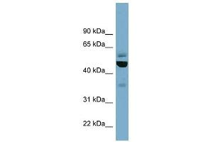 Epsilon Tubulin 1 antibody used at 1 ug/ml to detect target protein. (TUBE1 antibody  (Middle Region))