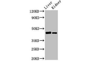 Western Blot Positive WB detected in: Rat liver tissue, Mouse kidney tissue All lanes: GALT antibody at 3 μg/mL Secondary Goat polyclonal to rabbit IgG at 1/50000 dilution Predicted band size: 44, 32 kDa Observed band size: 44 kDa (GALT antibody  (AA 1-379))