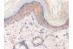 Detection of LXN in Rat Skin Tissue using Polyclonal Antibody to Latexin (LXN) (Latexin antibody  (AA 1-223))