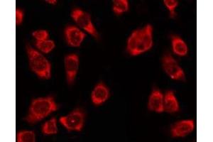 ABIN6278610 staining Hela by IF/ICC. (OR4K2 antibody  (C-Term))