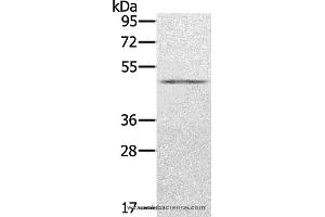 Western blot analysis of Human normal stomach tissue, using KDM8 Polyclonal Antibody at dilution of 1:500 (JMJD5 antibody)