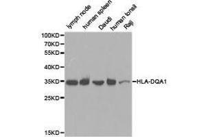 Western Blotting (WB) image for anti-Major Histocompatibility Complex, Class II, DQ alpha 1 (HLA-DQA1) antibody (ABIN1873029) (HLA-DQA1 antibody)