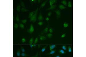 Immunofluorescence analysis of HeLa cells using ARRB1 Polyclonal Antibody (beta Arrestin 1 antibody)