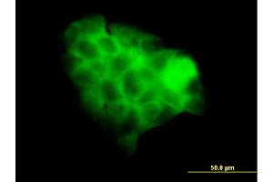 Immunofluorescence of monoclonal antibody to STAT2 on A-431 cell. (STAT2 antibody  (AA 742-851))