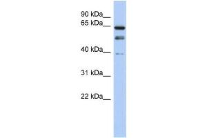 Western Blotting (WB) image for anti-MYST Histone Acetyltransferase 2 (MYST2) antibody (ABIN2457900) (MYST2 antibody)