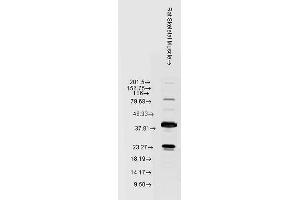 HSPB8 antibody  (HRP)