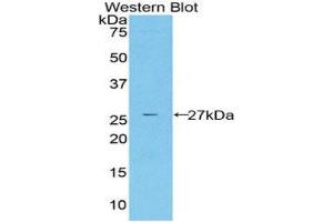 Western Blotting (WB) image for anti-Cysteine-Rich, Angiogenic Inducer, 61 (CYR61) (AA 178-381) antibody (ABIN1858600)