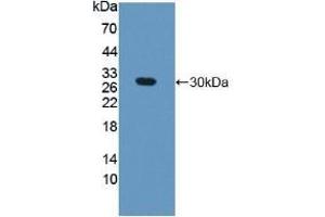 Detection of Recombinant GAMT, Mouse using Polyclonal Antibody to Guanidinoacetate-N-Methyltransferase (GAMT) (GAMT antibody  (AA 2-236))