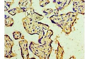 Immunohistochemistry of paraffin-embedded human placenta tissue using ABIN7150706 at dilution of 1:100 (MAP2K3 antibody  (AA 1-170))