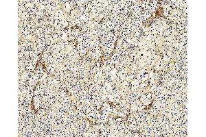 IHC analysis of Filamin A/FLNA using anti-Filamin A/FLNA antibody (ABIN7601783). (Filamin A antibody  (AA 451-638))