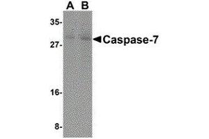 Western Blotting (WB) image for anti-Caspase 7, Apoptosis-Related Cysteine Peptidase (CASP7) (N-Term) antibody (ABIN2477919) (Caspase 7 antibody  (N-Term))