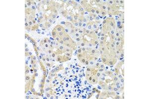Immunohistochemistry of paraffin-embedded mouse kidney using BSND antibody. (BSND antibody  (AA 54-320))