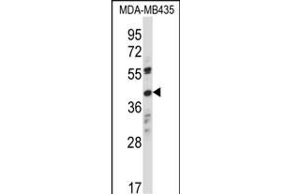 OR8K1 antibody  (C-Term)