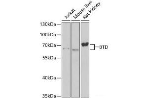 Western blot analysis of extracts of various cell lines using BTD Polyclonal Antibody at dilution of 1:1000. (BTD antibody)