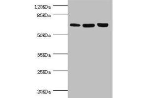 Western blot All lanes: CTNNBL1 antibody at 5. (CTNNBL1 antibody  (AA 264-563))