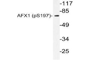Western blot (WB) analyzes of p-AFX1 antibody in extracts from COLO205 cells. (FOXO4 antibody  (pSer197))