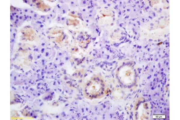 Thyroperoxidase antibody  (AA 111-210)